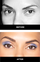 upturned eyes before and after