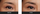 thin eyebrows