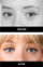 wide set eyes before and after