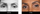 deep set eyes before and after